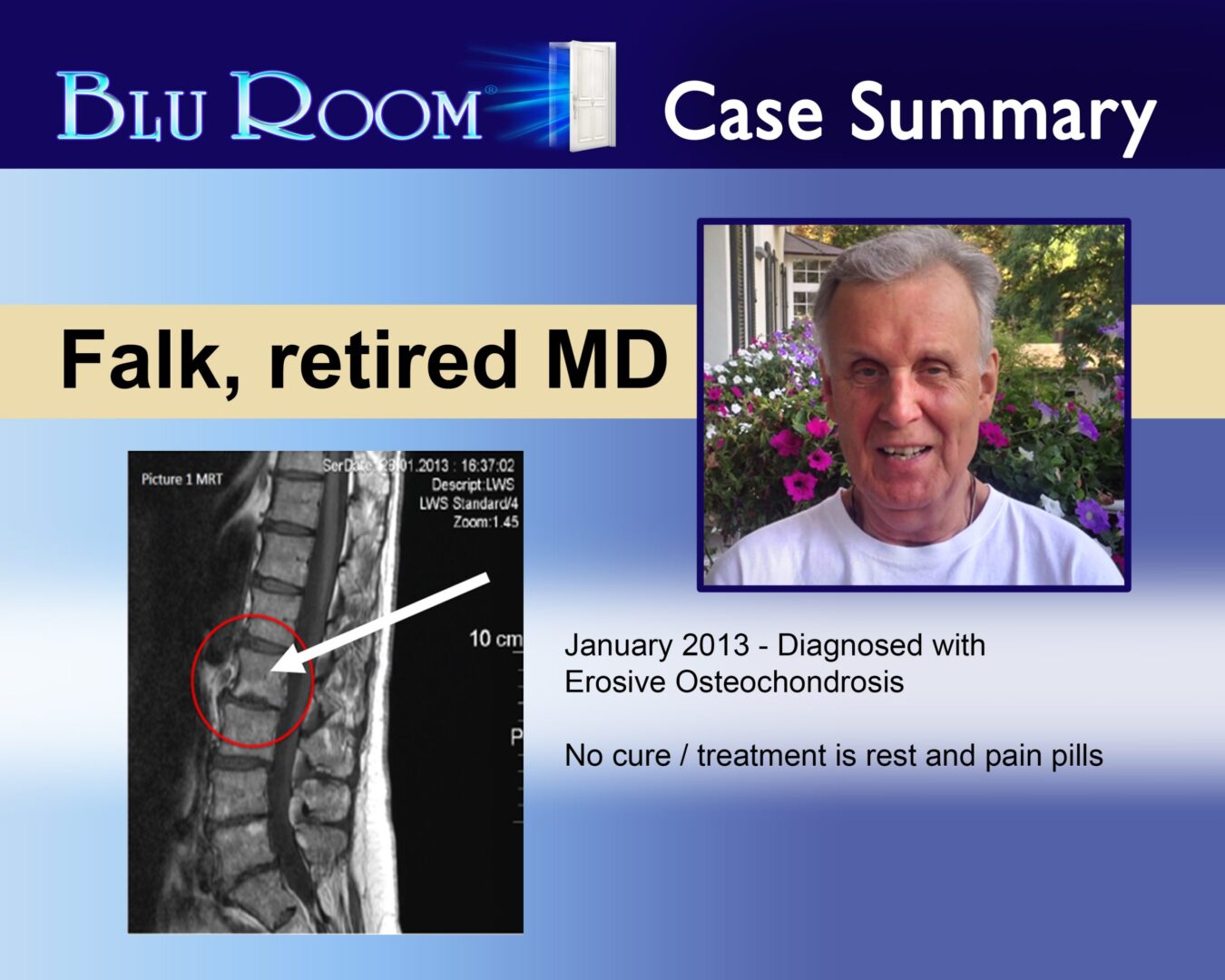 Falk, retired MD, case summary, MRI