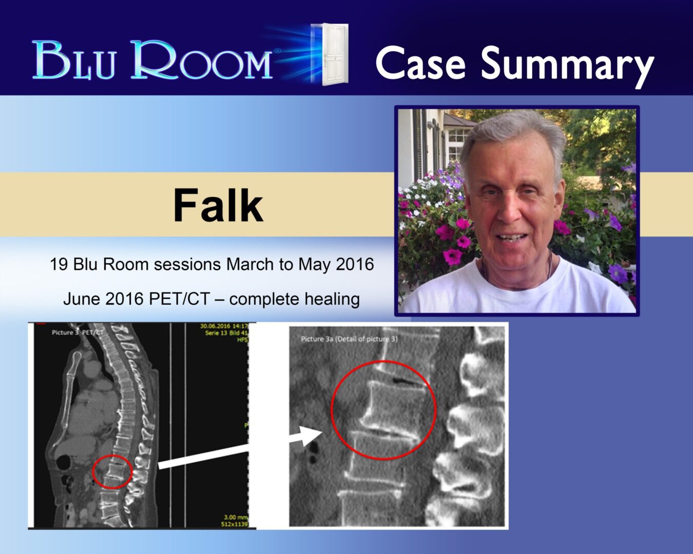 Falk's spine before and after healing.